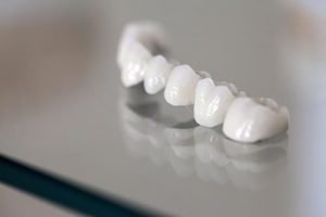 Dental Crowns and Bridges | Dentist Castlemaine