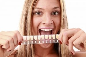 Dental Veneers | Dentist Castlemaine