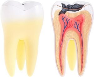 Tooth Decay Treatment | Dentist Castlemaine