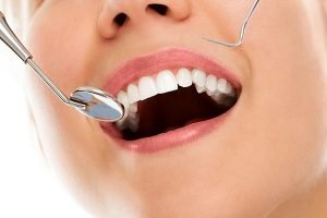 Castlemaine Smiles Dentist | Tooth Fillings Dentist Castlemaine
