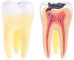 Dental Abscess | Dentist Castlemaine